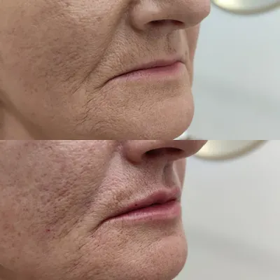 Medycyna Estetyczna Anna Butowska